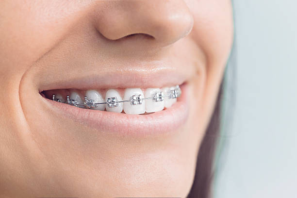 Best Invisalign and Clear Aligners  in Dunkirk, MD